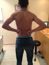Τελικό αποτέλεσμα μετά από τη συντηρητική αγωγή