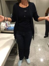 Τελικό αποτέλεσμα μετά από τη συντηρητική αγωγή